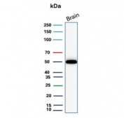 Western blot testing of human brain tissue with GFAP antibody (clone GFAP/9420). Predicted molecular weight ~50 kDa.