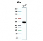 Western blot testing of human brain tissue with Glial fibrillary acidic protein antibody (clone GFAP/9426). Predicted molecular weight ~50 kDa.