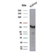Western blot testing of human kidney tissue with Glucose-6-phosphate isomerase antibody (clone GPI/2439). Predicted molecular weight ~63 kDa.