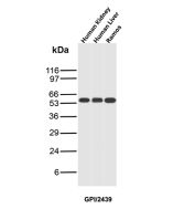 GPI Antibody Multi-Sample WB. Western blot analysis of human kidney, human liver, and Ramos lysates using Glucose 6-phosphate isomerase mouse monoclonal Antibody clone GPI/2439. Distinct bands are detected at approximately 55-60 kDa across kidney, liver, and Ramos samples, consistent with the predicted molecular weight of Glucose-6-phosphate isomerase / GPI, a glycolytic enzyme involved in glucose metabolism and cellular energy production. The observed expression pattern is consistent with the widespread metabolic role of GPI in both tissue-derived and hematopoietic cell populations.