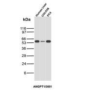 ANGPT1 Antibody Multi-Sample WB. Western blot analysis of Lane 1: human liver lysate, Lane 2: COLO38 cell lysate, and Lane 3: PC3 cell lysate using ANGPT1 Antibody clone ANGPT1/3651. A band is detected at approximately 57 kDa in all three samples, consistent with the predicted molecular weight of Angiopoietin-1 / ANGPT1. ANGPT1 is a secreted vascular growth factor that signals through the TEK/TIE2 receptor to regulate blood vessel maturation, vascular stability, and endothelial cell survival. The observed signal is consistent with the established expression of ANGPT1 in tissues and cell types involved in angiogenic and vascular regulatory pathways.