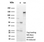 SDS-PAGE analysis of purified, BSA-free Hexokinase 1 antibody (clone HK1/9504) as confirmation of integrity and purity.