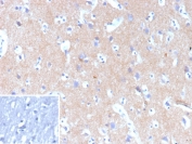 IHC staining of FFPE human brain tissue with Hexokinase 1 antibody (clone HK1/9504). Inset: PBS used in place of primary Ab (secondary Ab negative control). HIER: boil tissue sections in pH 9 10mM Tris with 1mM EDTA for 20 min and allow to cool before testing.