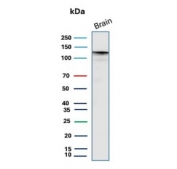 Western blot testing of human brain tissue lysate with HK1 antibody (clone HK1/9506). Predicted molecular weight ~120 kDa.