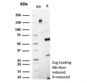 SDS-PAGE analysis of purified, BSA-free HK1 antibody (clone HK1/9507) as confirmation of integrity and purity.