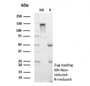 SDS-PAGE analysis of purified, BSA-free HK1 antibody (clone HK1/9508) as confirmation of integrity and purity.