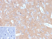 IHC staining of FFPE human brain tissue with HK1 antibody (clone HK1/9509). Inset: PBS used in place of primary Ab (secondary Ab negative control). HIER: boil tissue sections in pH 9 10mM Tris with 1mM EDTA for 20 min and allow to cool before testing.