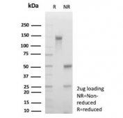 SDS-PAGE analysis of purified, BSA-free MHC class I antigen G antibody (clone HLAG/7749) as confirmation of integrity and purity.