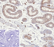 IHC staining of FFPE human testis tissue with Inhibin alpha chain antibody (clone INHA/9354). Inset: PBS used in place of primary Ab (secondary Ab negative control). HIER: boil tissue sections in pH 9 10mM Tris with 1mM EDTA for 20 min and allow to cool before testing.