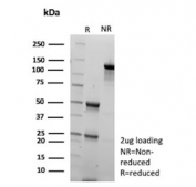 SDS-PAGE analysis of purified, BSA-free KNG1 antibody (clone KNG1/7422) as confirmation of integrity and purity.