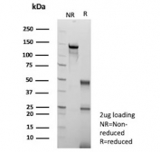 SDS-PAGE analysis of purified, BSA-free Liver Arginase antibody (clone ARG1/9447) as confirmation of integrity and purity.