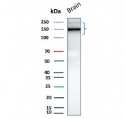 Western blot testing of human brain tissue lysate with Neural cell adhesion molecule L1 antibody (clone L1CAM/13053R). Predicted molecular weight ~140 kDa but can be observed at up to ~240 kDa due to glycosylation.