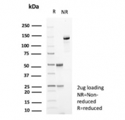SDS-PAGE analysis of purified, BSA-free Galectin 3 antibody (clone LGALS3/7145) as confirmation of integrity and purity.