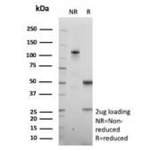 SDS-PAGE analysis of purified, BSA-free recombinant Galectin 3 antibody (clone LGALS3/13208R) as confirmation of integrity and purity.