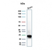 Western blot testing of human brain tissue lysate with MBP antibody (clone rMBP/9431). Predicted molecular weight: ~22 kDa, ~33 kDa (two isoforms).