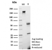 SDS-PAGE analysis of purified, BSA-free MRC1 antibody (clone MRC1/9454) as confirmation of integrity and purity.
