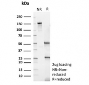 SDS-PAGE analysis of purified, BSA-free recombinant Myosin 7 antibody (clone MYH7/13050R) as confirmation of integrity and purity.