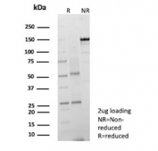 SDS-PAGE analysis of purified, BSA-free PD-Ibeta antibody (clone ENPP3/9891) as confirmation of integrity and purity.