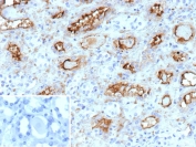 IHC staining of FFPE human kidney tissue with PD-Ibeta antibody (clone ENPP3/9892). Inset: PBS used in place of primary Ab (secondary Ab negative control). HIER: boil tissue sections in pH 9 10mM Tris with 1mM EDTA for 20 min and allow to cool before testing.