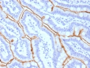 IHC staining of FFPE human small intestine tissue with MUC13 antibody (clone MUC13/13111). HIER: boil tissue sections in pH 9 10mM Tris with 1mM EDTA for 20 min and allow to cool before testing.