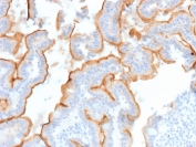 IHC staining of FFPE human small intestine tissue with MUC13 antibody (clone MUC13/13112). HIER: boil tissue sections in pH 9 10mM Tris with 1mM EDTA for 20 min and allow to cool before testing.