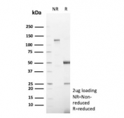 SDS-PAGE analysis of purified, BSA-free HEG1 antibody (clone HEG1/9445) as confirmation of integrity and purity.
