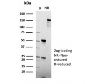 SDS-PAGE analysis of purified, BSA-free CEACAM1 antibody (clone CEACAM1/12659) as confirmation of integrity and purity.
