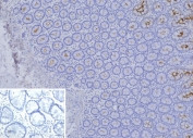 IHC staining of FFPE human colon tissue with Biliary glycoprotein 1 antibody (clone CEACAM1/12665). Inset: PBS used in place of primary Ab (secondary Ab negative control). HIER: boil tissue sections in pH 9 10mM Tris with 1mM EDTA for 20 min and allow to cool before testing.