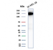 Western blot testing of human SK-MEL-28 cell lysate with Biliary glycoprotein 1 antibody (clone CEACAM1/12665). Predicted molecular weight ~58 kDa but may be observed at higher molecular weights due to heavy glycosylation.