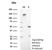 SDS-PAGE analysis of purified, BSA-free SMN1 antibody (clone SMN1/1596) as confirmation of integrity and purity.