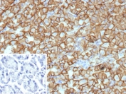 IHC staining of FFPE human stomach tissue with CA9 antibody (clone rCA9/9937). HIER: boil tissue sections in pH 9 10mM Tris with 1mM EDTA for 20 min and allow to cool before testing.