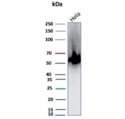 Western blot testing of human HeLa cell lysate with recombinant CA9 antibody (clone rCA9/9937). Predicted molecular weight: 50-55 kDa but may be observed at higher molecular weights due to glycosylation.
