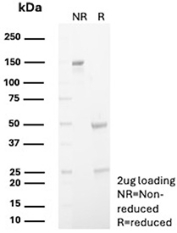 SDS-PAGE Analysis of Purified Calbindin / CALB1 antibody (rKR6). Confirmation of Purity and Integrity of Antibody.