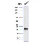Western blot testing of human brain tissue lysate with recombinant Calretinin antibody (clone CALB2/4688R). Predicted molecular weight ~29 kDa.