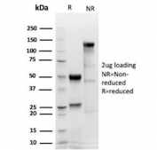 SDS-PAGE analysis of purified, BSA-free recombinant Calretinin antibody (clone CALB2/4688R) as confirmation of integrity and purity.