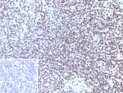 IHC staining of FFPE human tonsil tissue with Phosphorylated Histone H3 antibody (clone rHH3/9924). Inset: PBS used in place of primary Ab (secondary Ab negative control). HIER: boil tissue sections in pH 9 10mM Tris with 1mM EDTA for 20 min and allow to cool before testing.
