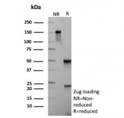 SDS-PAGE analysis of purified, BSA-free ADPRC1 antibody (clone CD38/9333) as confirmation of integrity and purity.