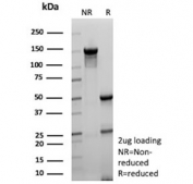 SDS-PAGE analysis of purified, BSA-free Kallikrein 4 antibody (clone KLK4/8943) as confirmation of integrity and purity.