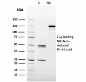 SDS-PAGE analysis of purified, BSA-free HPV-16 antibody (clone 4B12) as confirmation of integrity and purity.