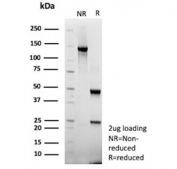 SDS-PAGE analysis of purified, BSA-free Cytomegalovirus antibody (clone rCMV/9827) as confirmation of integrity and purity.