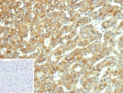 IHC staining of FFPE human hepatocellular carcinoma tissue with Cytochrome P450 2C9 antibody (clone CYP2C9/13122). Inset: PBS used in place of primary Ab (secondary Ab negative control). HIER: boil tissue sections in pH 9 10mM Tris with 1mM EDTA for 20 min and allow to cool before testing.