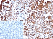 IHC staining of FFPE human tonsil tissue with ANXA1 antibody (clone rANXA1/9145). HIER: boil tissue sections in pH 9 10mM Tris with 1mM EDTA for 20 min and allow to cool before testing.