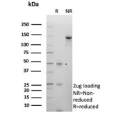 SDS-PAGE Analysis of CDH6/Cadherin 6 Antibody (clone CDH6/9347). Confirmation of Purity and Integrity of Antibody.
