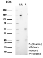 SDS-PAGE Analysis of Purified CELA3A/Chymotrypsin like elastase 3A Antibody (CELA3A/12553). Confirmation of Purity and Integrity of Antibody.
