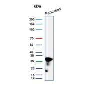 Western blot analysis of CELA3A expression. Human pancreas tissue lysate was analyzed by SDS-PAGE and immunoblotting using a CELA3A/Chymotrypsin like elastase 3A antibody (clone CELA3A/12553). A prominent band is detected at the predicted molecular weight (~29 kDa) corresponding to Chymotrypsin like elastase 3A, with an additional lower molecular weight band consistent with proteolytically processed forms commonly observed for pancreatic digestive enzymes.
