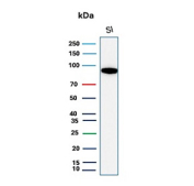 Western blot analysis of human small intestine tissue lysate using CDH17/Cadherin 17 antibody (clone CDH17/2613). Predicted molecular weight ~92 kDa but may be observed at higher molecular weights due to glycosylation.