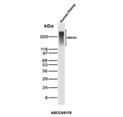 Western blot analysis of ABCC4 in human kidney lysate using an ABCC4 antibody (clone ABCC4/9178). A broad immunoreactive band is detected in the ~200 kDa region, consistent with the predicted molecular weight of ATP-binding cassette sub-family C member 4. The diffuse migration pattern may reflect heterogenous electrophoretic mobility often observed for large, multi-pass membrane transporters.