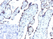 Immunohistochemical analysis of CDKN1B in FFPE human placenta using a CDKN1B/p27Kip1 antibody (clone r1B4). Distinct nuclear staining is observed in placental cells, consistent with Cyclin-dependent kinase inhibitor 1B localization. Staining of formalin-fixed tissues requires heating tissue sections in 10 mM Tris with 1 mM EDTA, pH 9.0, for 45 minutes at 95 C followed by cooling at room temperature for 20 minutes. Inset shows a negative control section processed in parallel using PBS in place of the primary antibody, demonstrating minimal background staining.