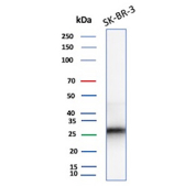Western blot analysis of human SK-BR-3 cell lysates using CDKN1B/Cyclin-dependent kinase inhibitor 1B antibody (clone r1B4).