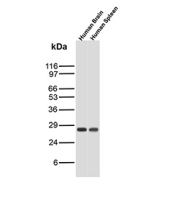 Western blot analysis of human brain and human spleen tissue lysates using CDKN1B/Cyclin-dependent kinase inhibitor 1B antibody (clone r1B4).